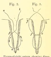An illustration from The American journal of the medical sciences (1827)