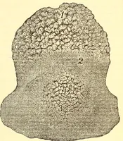 An illustration from The American journal of the medical sciences (1827)
