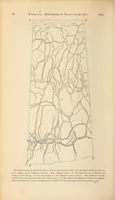 Picture 3 of 17 from The American journal of the medical sciences (1827), leaf 102