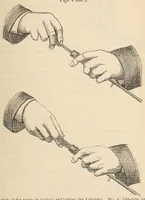 An illustration from The American journal of the medical sciences (1827)