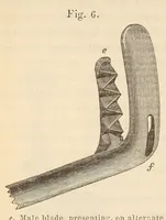 An illustration from The American journal of the medical sciences (1827)
