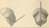 Picture 8 of 17 from The American journal of the medical sciences (1827), leaf 134