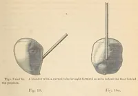 Picture 10 of 17 from The American journal of the medical sciences (1827), leaf 135
