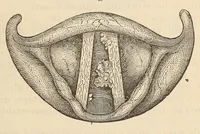 An illustration from The American journal of the medical sciences (1827)