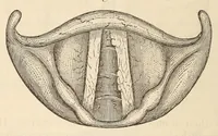 An illustration from The American journal of the medical sciences (1827)