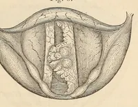An illustration from The American journal of the medical sciences (1827)