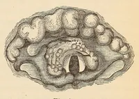An illustration from The American journal of the medical sciences (1827)