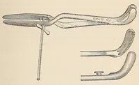 An illustration from The American journal of the medical sciences (1827)