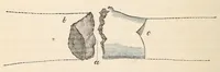 An illustration from The American journal of the medical sciences (1827)
