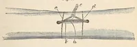 An illustration from The American journal of the medical sciences (1827)