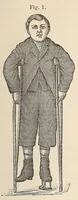 Picture 3 of 9 from The American journal of the medical sciences (1827), leaf 71