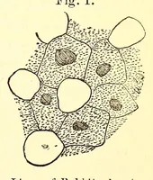 An illustration from The American journal of the medical sciences (1827)