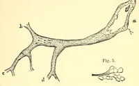 An illustration from The American journal of the medical sciences (1827)