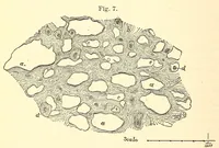 An illustration from The American journal of the medical sciences (1827)