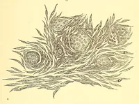 An illustration from The American journal of the medical sciences (1827)