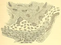 An illustration from The American journal of the medical sciences (1827)