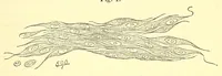 An illustration from The American journal of the medical sciences (1827)