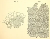 An illustration from The American journal of the medical sciences (1827)