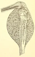 An illustration from The American journal of the medical sciences (1827)