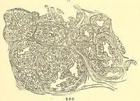 An illustration from The American journal of the medical sciences (1827)