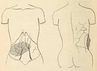 An illustration from The American journal of the medical sciences (1827)