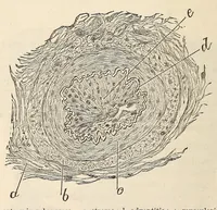 An illustration from The American journal of the medical sciences (1827)