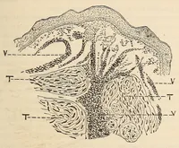 An illustration from The American journal of the medical sciences (1827)
