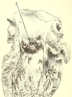An illustration from The American journal of the medical sciences (1827)