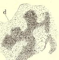 An illustration from The American journal of the medical sciences (1827)