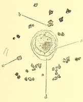 Picture 6 of 14 from The American journal of the medical sciences (1827), leaf 35