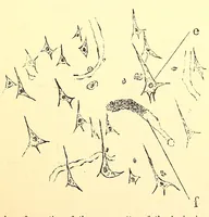An illustration from The American journal of the medical sciences (1827)