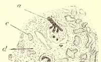 An illustration from The American journal of the medical sciences (1827)