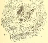 An illustration from The American journal of the medical sciences (1827)