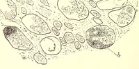 An illustration from The American journal of the medical sciences (1827)