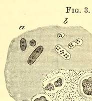 An illustration from The American journal of the medical sciences (1827)