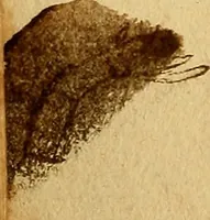 An illustration from Anatomia chirurgica cioè istoria anatomica dell'ossa, e muscoli del corpo umano : con la descrizzione de'vasi, che scorrono per le parti esterne, & in particolare par gl'articoli, & un breve trattato della circolazione del sangue in quest terza impressione riformata, & accresciuta di molte riflessioni pathologiche-chirurgiche (1687)