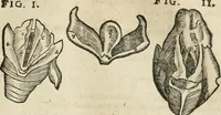 Picture 74 of 129 from Anatomiae amphitheatrvm effigie triplici, more et conditione varia, designatvm (1623), leaf 150
