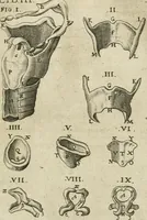 Picture 76 of 129 from Anatomiae amphitheatrvm effigie triplici, more et conditione varia, designatvm (1623), leaf 152