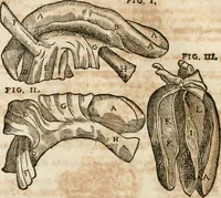 An illustration from Anatomiae amphitheatrvm effigie triplici, more et conditione varia, designatvm (1623)