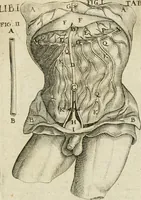 An illustration from Anatomiae amphitheatrvm effigie triplici, more et conditione varia, designatvm (1623)