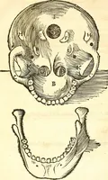 An illustration from Anatomiae, hoc est, corporis humani dissectionis pars prior, in qua singula quae ad caput spectant recensentur membra atque singulae partes, singulis suis ad uiuum commodissimè expressis figuris, deliniantur (1537)