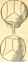 An illustration from Anatomiae, hoc est, corporis humani dissectionis pars prior, in qua singula quae ad caput spectant recensentur membra atque singulae partes, singulis suis ad uiuum commodissimè expressis figuris, deliniantur (1537)