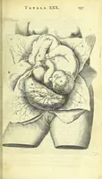 An illustration from Anatomia, ex Caspari Bartholini parentis Institutionibus : (1666)