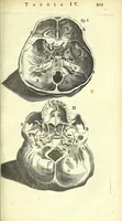 An illustration from Anatomia, ex Caspari Bartholini parentis Institutionibus : (1666)