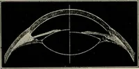An illustration from Anatomy and physiology of the eye, with hints for the preservation of the eyesight (1901)