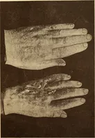 An illustration from Animismus und spiritismus. Versuch einer kritischen prüfung der mediumistischen phänomene mit besonderer berücksichtigung der hypothesen der hallucination und des unbewussten. Als entgegnung auf Ed. v. Hartmann's Werk: "Der spiritismus." (1894)