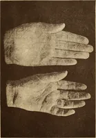 An illustration from Animismus und spiritismus. Versuch einer kritischen prüfung der mediumistischen phänomene mit besonderer berücksichtigung der hypothesen der hallucination und des unbewussten. Als entgegnung auf Ed. v. Hartmann's Werk: "Der spiritismus." (1894)