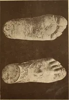 An illustration from Animismus und spiritismus. Versuch einer kritischen prüfung der mediumistischen phänomene mit besonderer berücksichtigung der hypothesen der hallucination und des unbewussten. Als entgegnung auf Ed. v. Hartmann's Werk: "Der spiritismus." (1894)