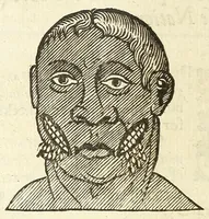 An illustration from Anthropometamorphosis: man transform'd: or, The artificiall changling, historically presented, in the mad and cruel gallantry, foolish bravery, ridiculous beauty, filthy finenesse, and loathsome loveliness of most nations, fashioning and altering their bodies from the mould intended by nature; with figures of those transformations. To which artificial and affected deformations are added, all the native and national monstrosities that have appeared to disfigure the humane fabrick. With a vindication of the regular beauty and honesty of nature (1653)
