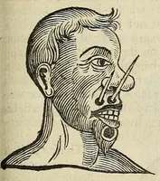 An illustration from Anthropometamorphosis: man transform'd: or, The artificiall changling, historically presented, in the mad and cruel gallantry, foolish bravery, ridiculous beauty, filthy finenesse, and loathsome loveliness of most nations, fashioning and altering their bodies from the mould intended by nature; with figures of those transformations. To which artificial and affected deformations are added, all the native and national monstrosities that have appeared to disfigure the humane fabrick. With a vindication of the regular beauty and honesty of nature (1653)